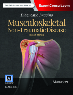 Diagnostic Imaging: Musculoskeletal Non-Traumatic Disease E-Book Diagnostic Imaging: Musculoskeletal Non-Traumatic Disease E-Book