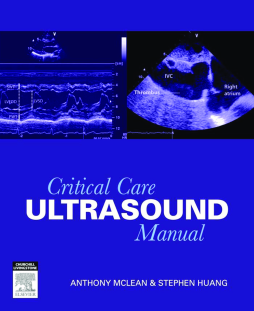 Critical Care Ultrasound Manual - Enhanced Critical Care Ultrasound Manual - Enhanced
