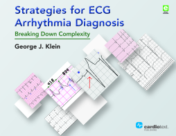Strategies for ECG Arrhythmia Diagnosis Strategies for ECG Arrhythmia Diagnosis