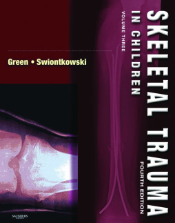 Skeletal Trauma in Children E-Book Skeletal Trauma in Children E-Book