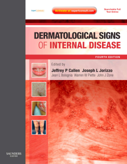 Dermatological Signs of Internal Disease E-Book Dermatological Signs of Internal Disease E-Book