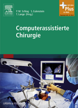 Computerassistierte Chirurgie Computerassistierte Chirurgie