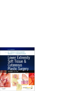 Lower Extremity Soft Tissue & Cutaneous Plastic Surgery E-Book