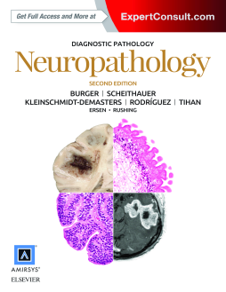 Diagnostic Pathology: Neuropathology E-Book Diagnostic Pathology: Neuropathology E-Book