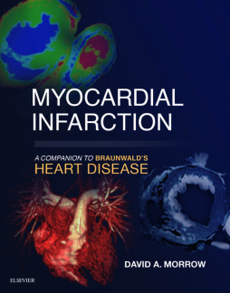 Myocardial Infarction: A Companion to Braunwald's Heart Disease E-Book Myocardial Infarction: A Companion to Braunwald's Heart Disease E-Book