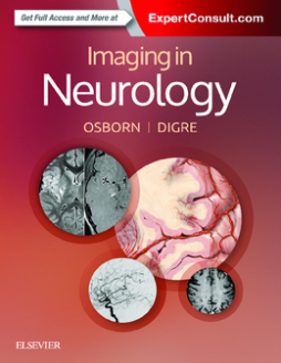 Imaging in Neurology E-Book