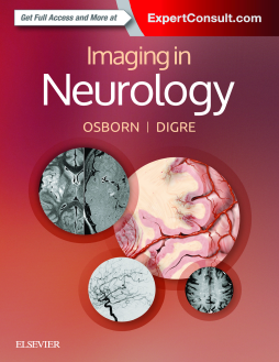 Imaging in Neurology E-Book Imaging in Neurology E-Book