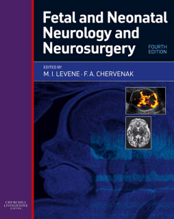 Fetal and Neonatal Neurology and Neurosurgery E-Book Fetal and Neonatal Neurology and Neurosurgery E-Book