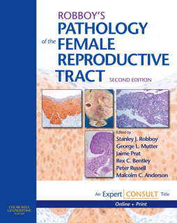 E-Book - Pathology of the Female Reproductive Tract E-Book - Pathology of the Female Reproductive Tract