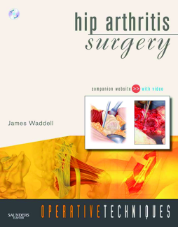Operative Techniques: Hip Arthritis Surgery- E- Book