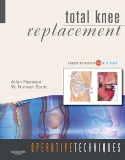 Operative Techniques: Total Knee Replacement E-Book