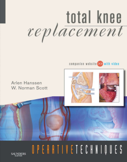 Operative Techniques: Total Knee Replacement E-Book Operative Techniques: Total Knee Replacement E-Book