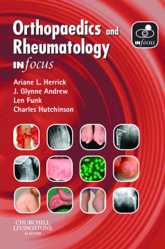 Orthopaedics and Rheumatology In Focus E-Book Orthopaedics and Rheumatology In Focus E-Book