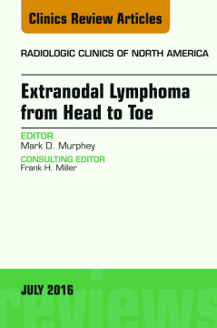 Extranodal Lymphoma from Head to Toe, An Issue of Radiologic Clinics of North America, E-Book Extranodal Lymphoma from Head to Toe, An Issue of Radiologic Clinics of North America, E-Book