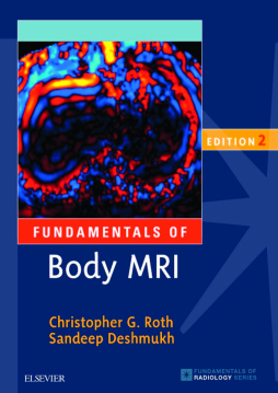 Fundamentals of Body MRI E-Book Fundamentals of Body MRI E-Book