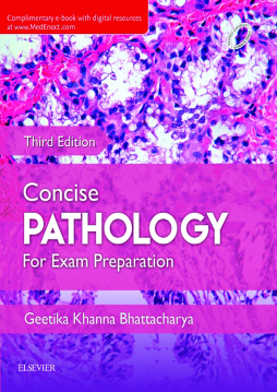 Concise Pathology for Exam Preparation - E-BooK Concise Pathology for Exam Preparation - E-BooK