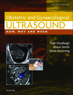 LIC - Obstetric & Gynaecological Ultrasound Ebk LIC - Obstetric & Gynaecological Ultrasound Ebk