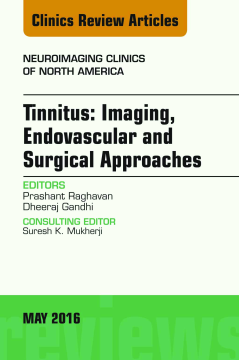 Tinnitus: Imaging, Endovascular and Surgical Approaches, An issue of Neuroimaging Clinics of North America, E-Book Tinnitus: Imaging, Endovascular and Surgical Approaches, An issue of Neuroimaging Clinics of North America, E-Book