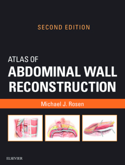Atlas of Abdominal Wall Reconstruction E-Book Atlas of Abdominal Wall Reconstruction E-Book
