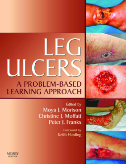 Leg Ulcers E-Book Leg Ulcers E-Book