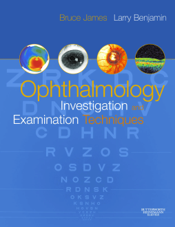 E-Book - Ophthalmology: Investigation and Examination Techniques E-Book - Ophthalmology: Investigation and Examination Techniques
