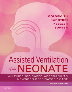 Assisted Ventilation of the Neonate E-Book Assisted Ventilation of the Neonate E-Book