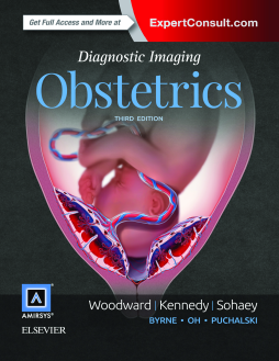Diagnostic Imaging: Obstetrics E-Book Diagnostic Imaging: Obstetrics E-Book