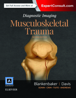 Diagnostic Imaging: Musculoskeletal Trauma E-Book Diagnostic Imaging: Musculoskeletal Trauma E-Book