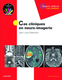 Cas cliniques en  neuro-imagerie