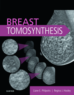 Breast Tomosynthesis E-Book Breast Tomosynthesis E-Book
