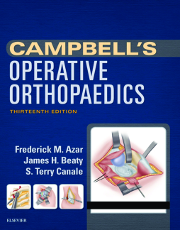 Campbell's Operative Orthopaedics E-Book Campbell's Operative Orthopaedics E-Book
