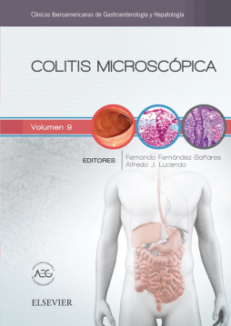 Colitis microscópica Colitis microscópica