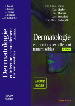 Dermatologie et infections sexuellement transmissibles Dermatologie et infections sexuellement transmissibles
