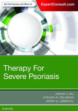 Therapy for Severe Psoriasis E-Book Therapy for Severe Psoriasis E-Book