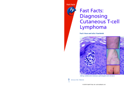 Fast Facts: Diagnosing Cutaneous T-cell Lymphoma Fast Facts: Diagnosing Cutaneous T-cell Lymphoma