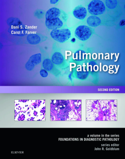 Pulmonary Pathology E-Book Pulmonary Pathology E-Book