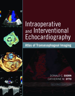 Intraoperative and Interventional Echocardiography Intraoperative and Interventional Echocardiography