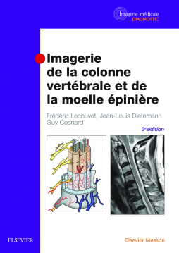 Imagerie de la colonne vertébrale et de la moelle épinière Imagerie de la colonne vertébrale et de la moelle épinière