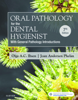 Oral Pathology for the Dental Hygienist - E-Book Oral Pathology for the Dental Hygienist - E-Book