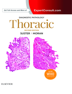 Diagnostic Pathology: Thoracic E-Book Diagnostic Pathology: Thoracic E-Book