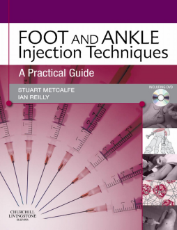 SD - Foot and Ankle Injection Techniques E-Book