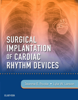 Surgical Implantation of Cardiac Rhythm Devices E-Book Surgical Implantation of Cardiac Rhythm Devices E-Book