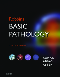 Robbins Basic Pathology E-Book Robbins Basic Pathology E-Book