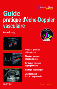 Guide pratique d'écho-Doppler vasculaire Guide pratique d'écho-Doppler vasculaire