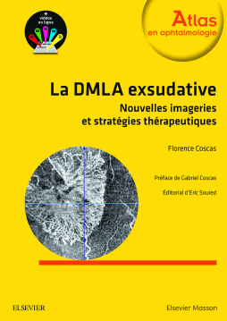 La DMLA exsudative La DMLA exsudative