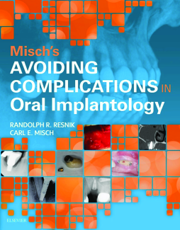 Misch's Avoiding Complications in Oral Implantology - E-Book Misch's Avoiding Complications in Oral Implantology - E-Book