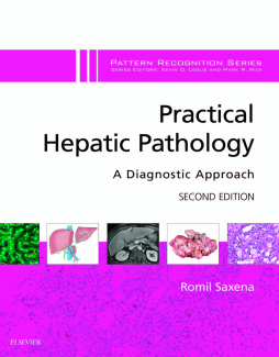 Practical Hepatic Pathology: A Diagnostic Approach E-Book Practical Hepatic Pathology: A Diagnostic Approach E-Book