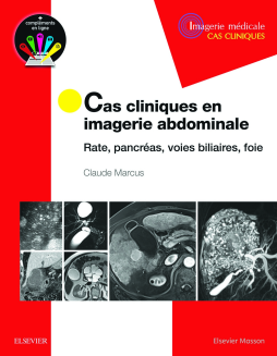 Cas cliniques en imagerie abdominale Cas cliniques en imagerie abdominale