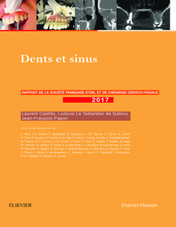 Dents et sinus Dents et sinus