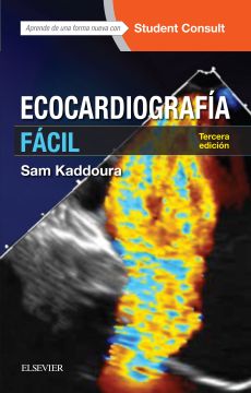 Ecocardiografía fácil Ecocardiografía fácil